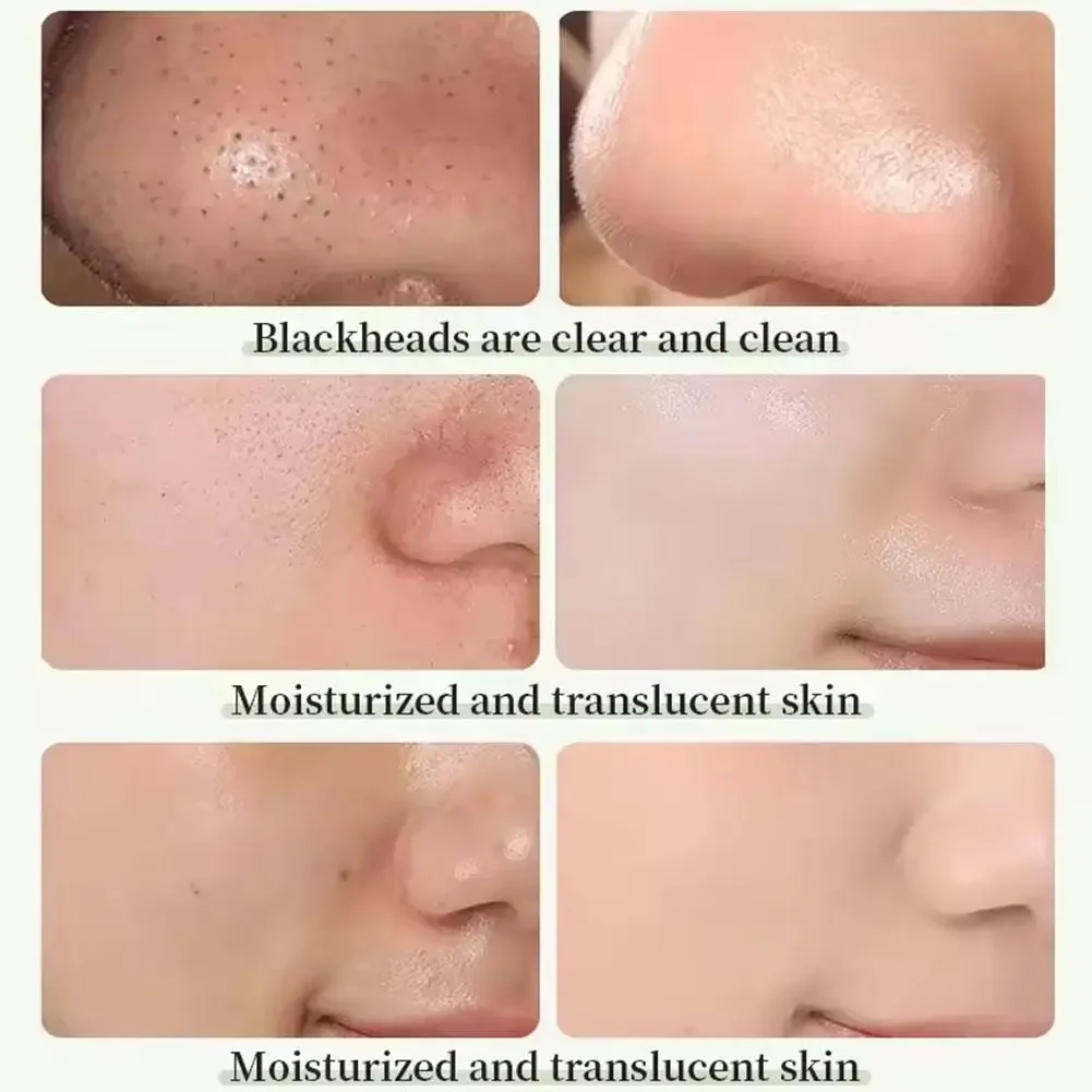 Green Tea Eggplant Solid Mask Deep Cleansing Oil Control Balance Antioxidan Shrink Pores Remove Blackheads Refreshing Mud Mask Green Tea Eggplant Solid Mask Deep Cleansing Oil Control Balance Antioxidan Shrink Pores Remove Blackheads Refreshing Mud Mask