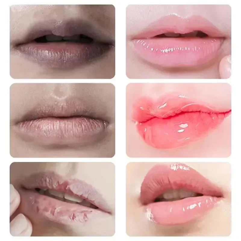 Lip Balm For Remove Dark Lip Melanin Dead Skin Removal Lighten Lip Lines Exfoliate Whitening Moisturizing Nourishing Serum 8.5g Lip Balm For Remove Dark Lip Melanin Dead Skin Removal Lighten Lip Lines Exfoliate Whitening Moisturizing Nourishing Serum 8.5g